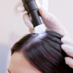 Intradermoterapia Capilar | Dra. Letícia Fachinelli