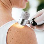 Exérese de Lesões Cutâneas | Dra. Letícia Fachinelli