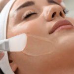 Peeling | Dra. Letícia Fachinelli | Dermatologia