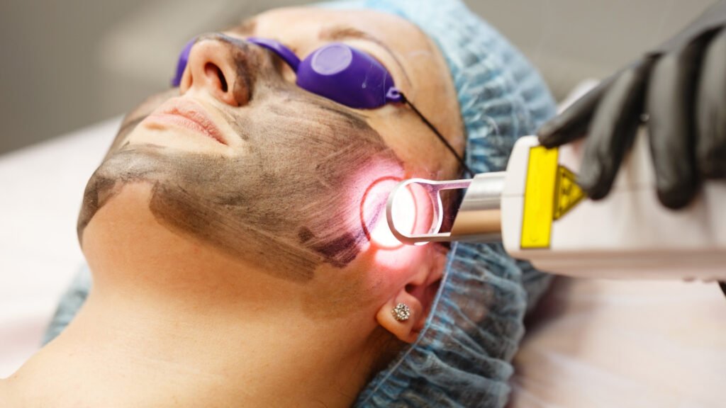 Laser Acroma | Dra. Letícia Fachinelli | Dermatologia